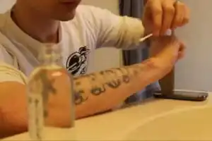 Peelings quimicos para remover tatuagem