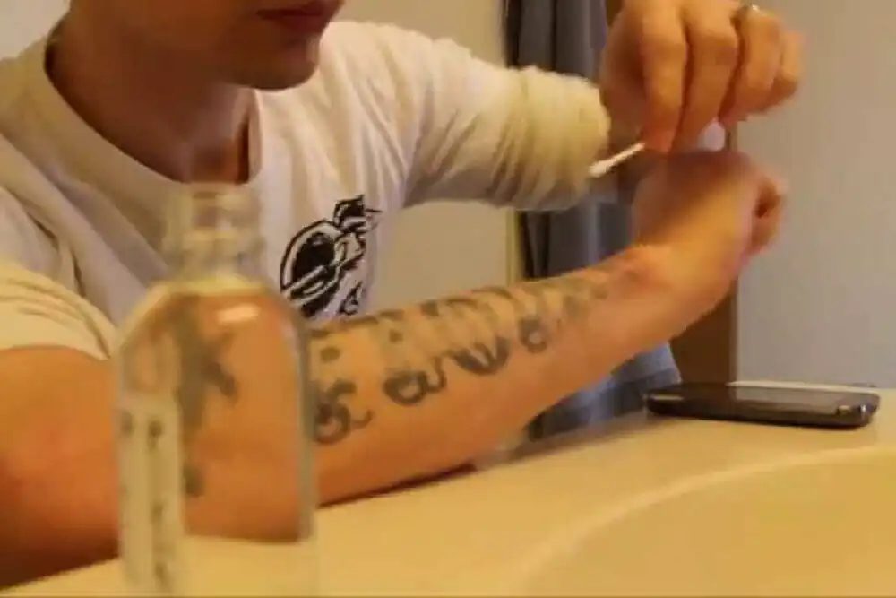 Peelings quimicos para remover tatuagem