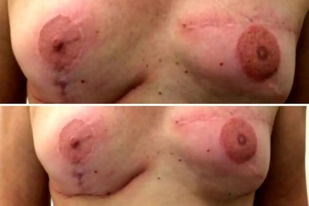 tatuagem 3D nos seios