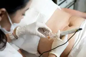 camuflagem de estrias