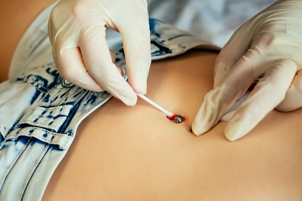 Cicatrização do Piercing no Umbigo: Dicas para uma cura rápida e segura cuidados e cicatrização do piercing no umbigo
