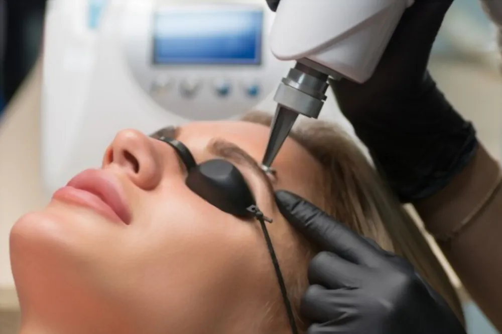 Como remover micropigmentação? Tire todas suas dúvidas sobre o procedimento como remover micropigmentação