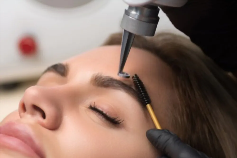 despigmentação de sobrancelhas a laser
