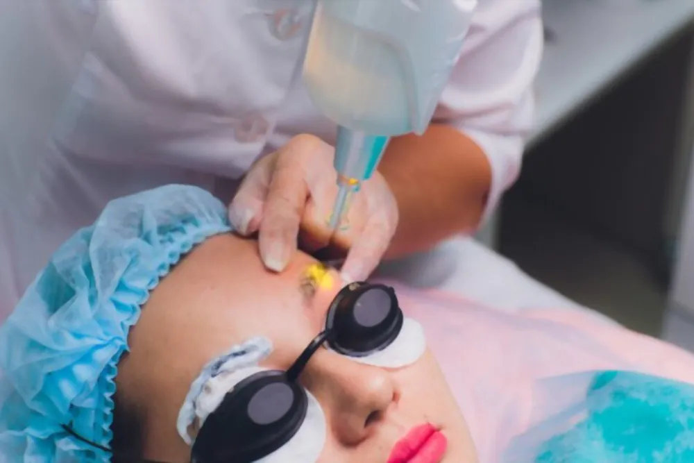 despigmentação de sobrancelhas