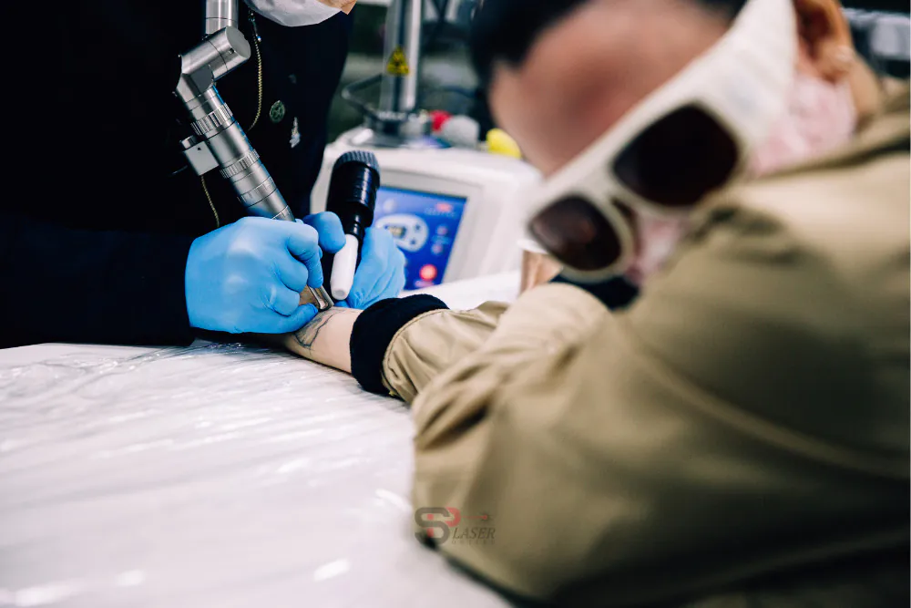 Remoção a laser doi muito