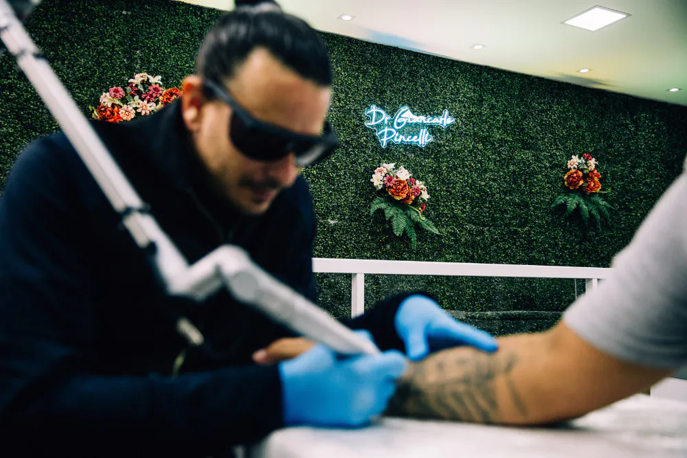 motivos para remover uma tatuagem
