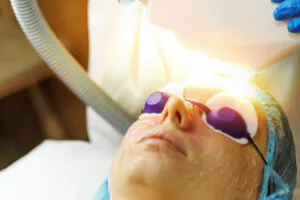 Tratamento Laser para Rejuvenescimento