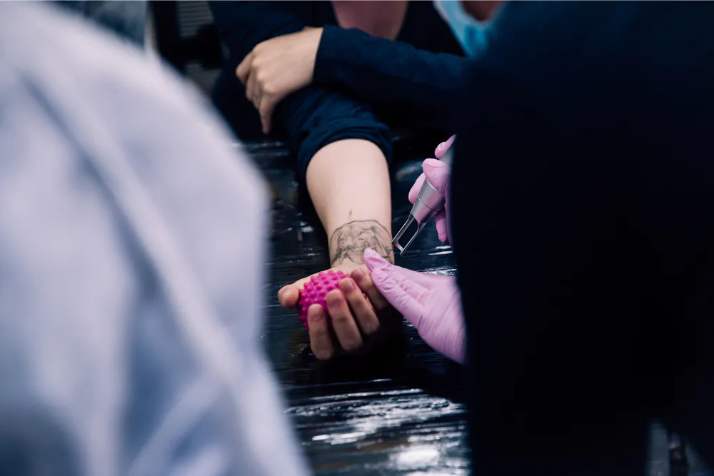 hiperpigmentação e hipopigmentação