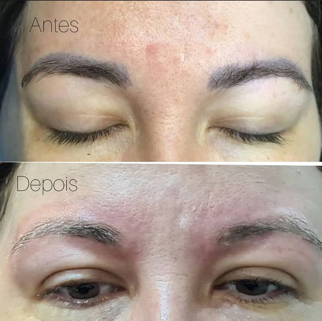 Sobrancelha Preta (1)