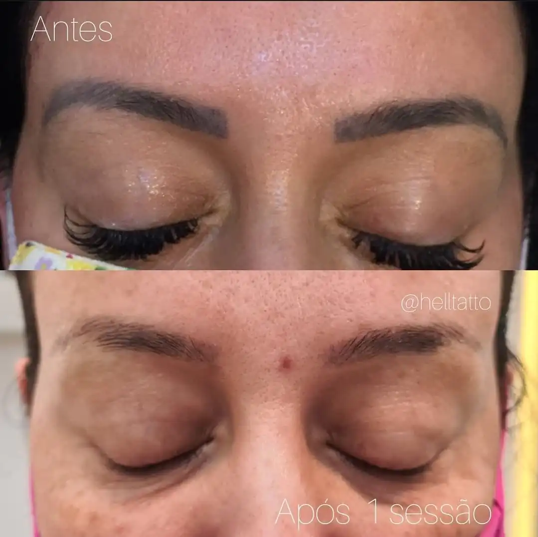 Sobrancelha Preta (3)