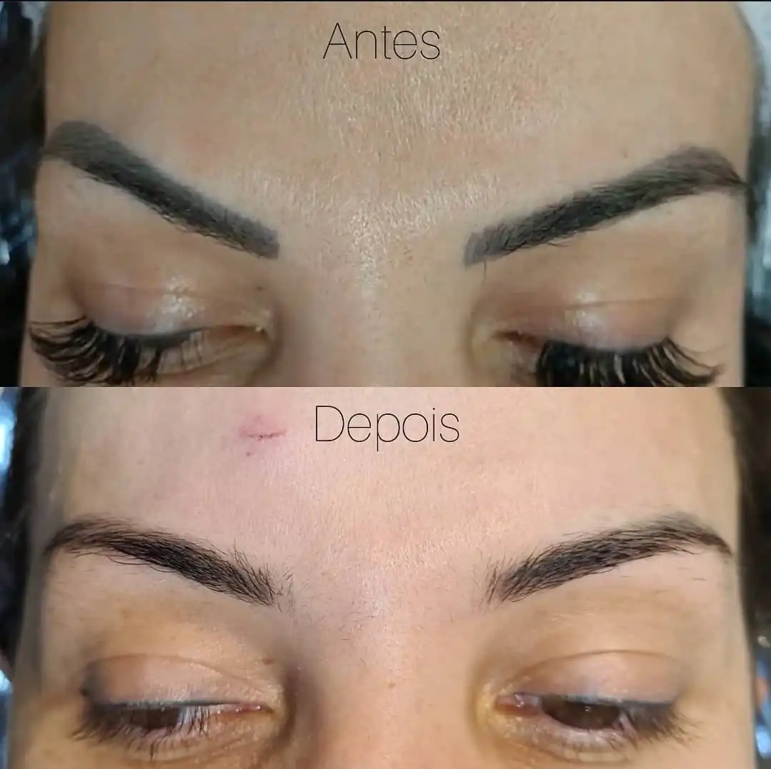 Sobrancelha Preta (4)