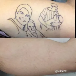 Remover Tatuagem 100%