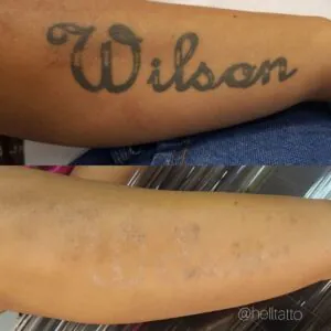 5-tipos-de-tatuagens-mais-removidas-na-hell-tattoo-03