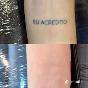 momento-ideal-para-iniciar-minha-remocao