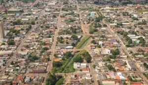 remocao-de-tatuagem-em-rondonia