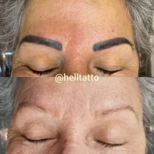 qual-e-o-valor-da-remocao-de-micropigmentacao-de-sobrancelhas