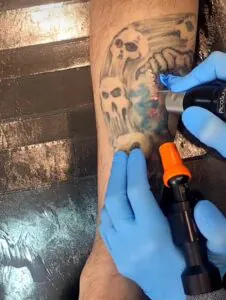 Orçamento remoção de tatuagem