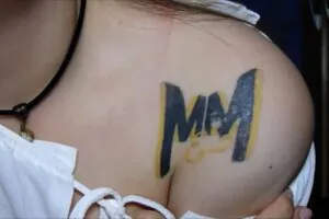 confira-como-foi-a-remocao-de-tatuagem-da-isabela-karasiak