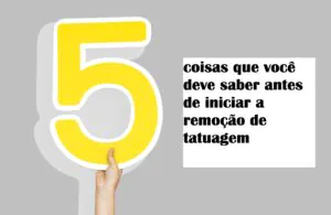 coisas-que-voce-deve-saber-antes-de-iniciar-a-remocao-de-tatuagem