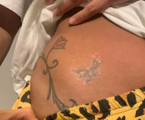 5-famosos-que-ja-fizeram-remocao-de-tatuagem - Foto: Reprodução