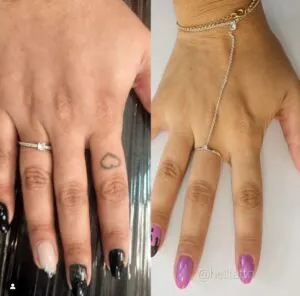 tudo-sobre-remocao-de-tatuagem-01