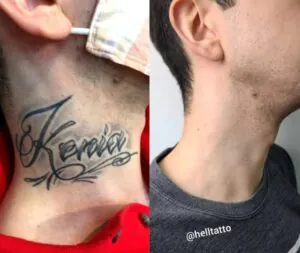 5-tatuagens-que-as-pessoas-normalmente-se-arrependem-de-fazer-02