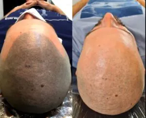 tatuagens-de-pontilhismo-e-facil-de-remover