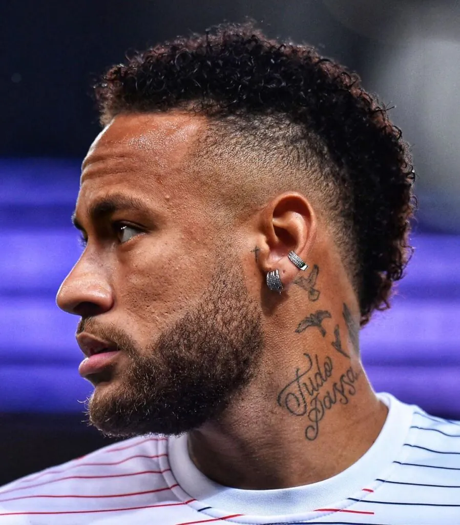 Remoção de tatuagem no pescoço