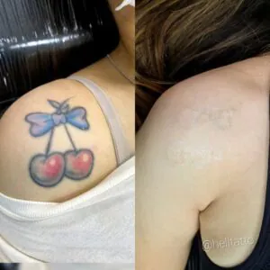 Tatuagens de má qualidade