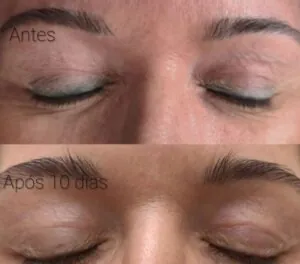 tem-como-remover-um-delineado-definitivo