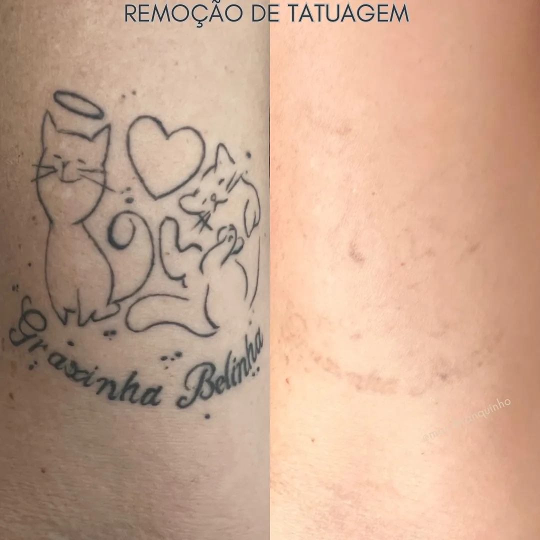 helltattoogoiania_1731982207978