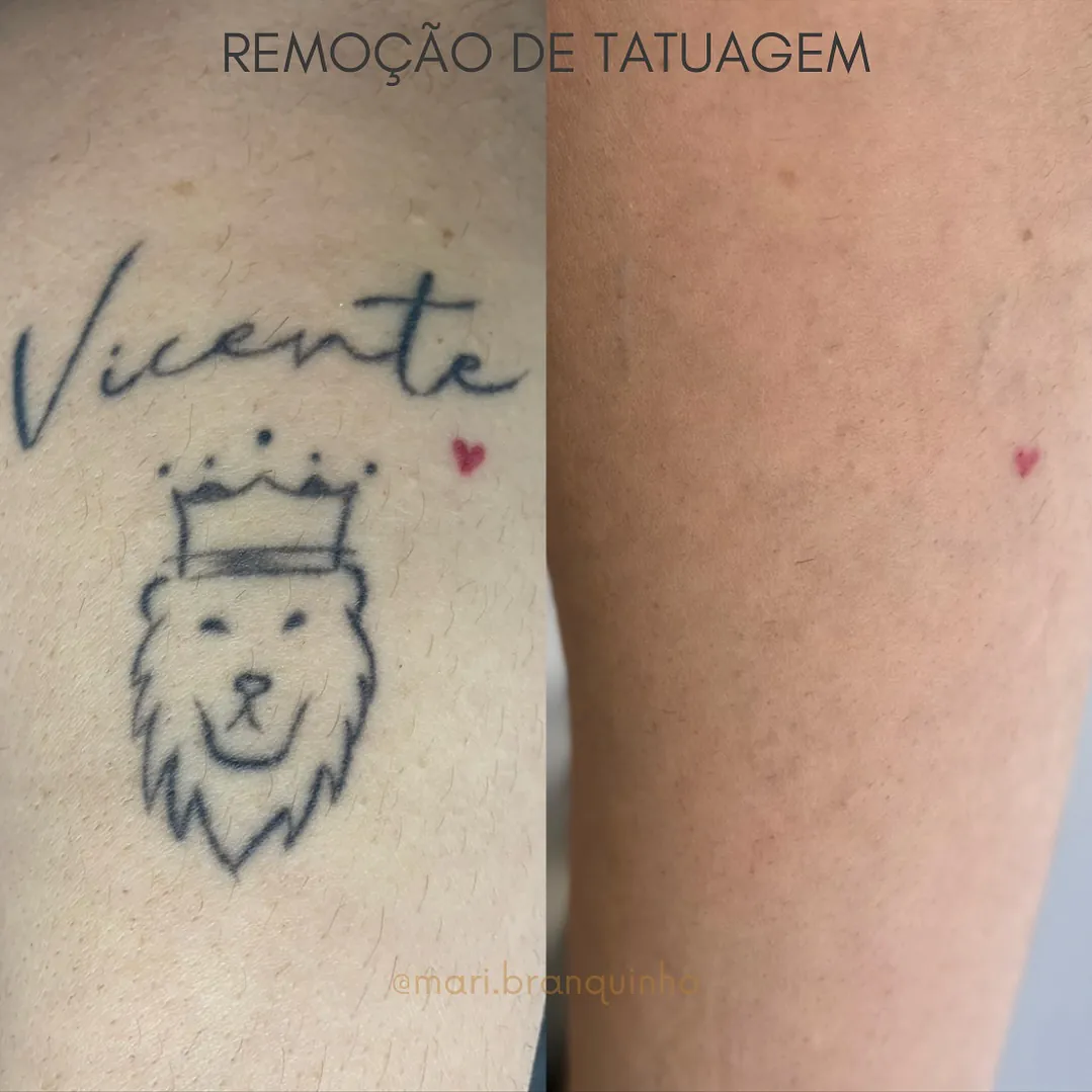 helltattoogoiania_1731982271557
