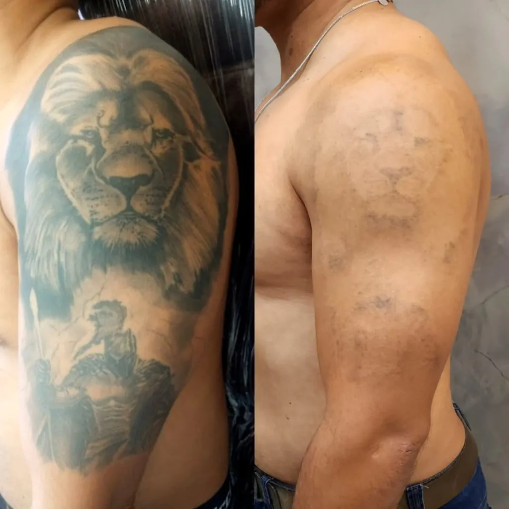 quantos-anos-dura-uma-tatuagem-1