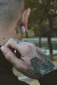 remoção de tatuagem a laser imagem