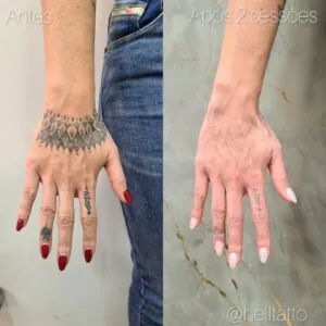 tatuagens-que-as-pessoas-mais-se-arrependem