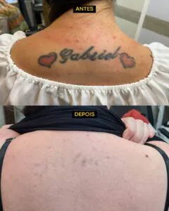 tatuagens-que-as-pessoas-mais-se-arrependem