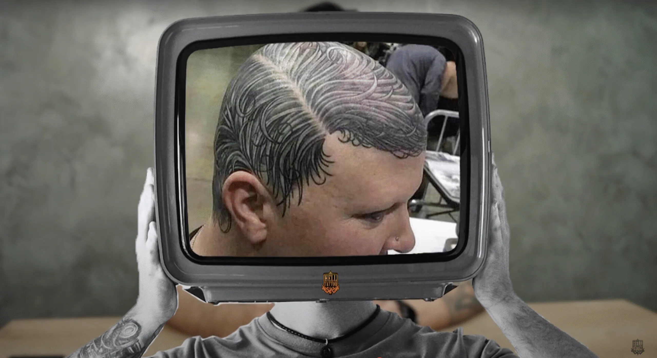 Remoção de Micropigmentação Capilar