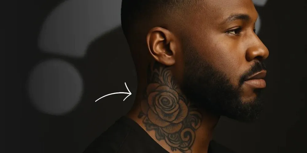 Remoção de Tatuagem em Peles Escuras