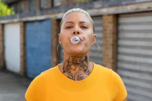 remoção de tatuagem geração z 2