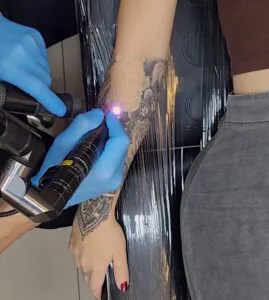 porque-tantas-pessoas-estao-removendo-suas-tatuagens-02