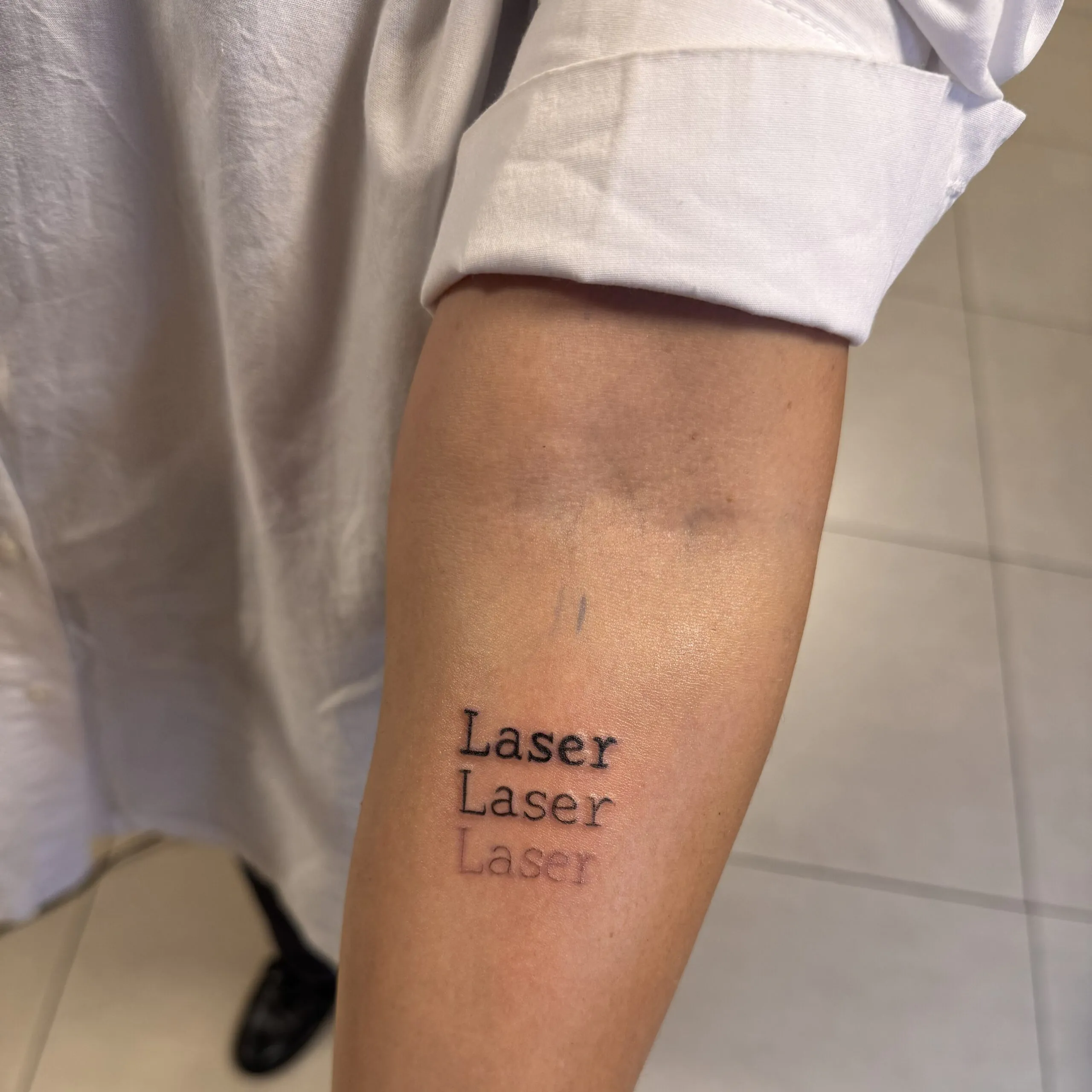 especialista-em-remocao-a-laser-tatua-a-propria-pele-01