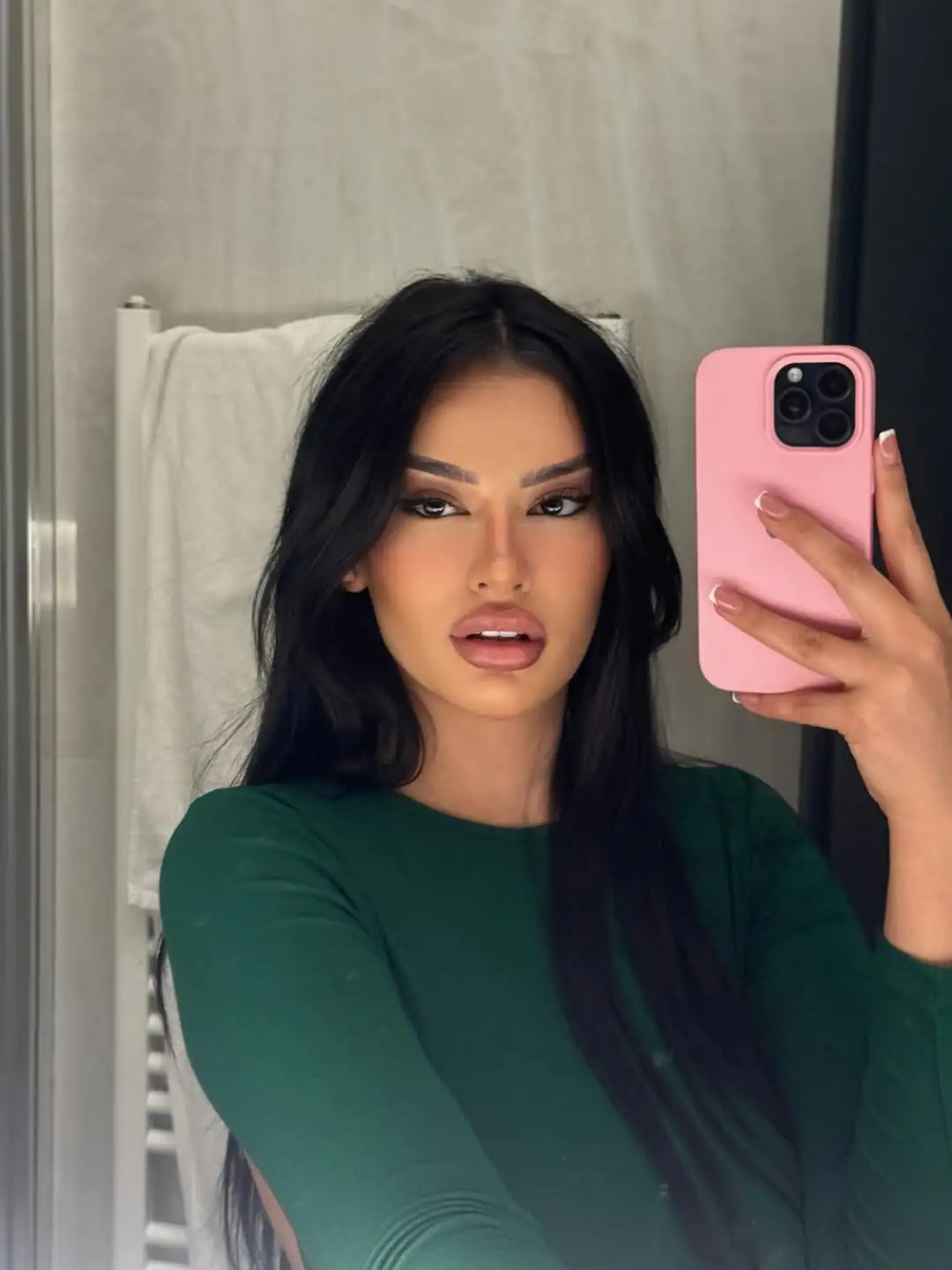 remoção de tatuagem sosia kylie jane - Foto: reprodução Instagram