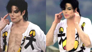 vitiligo michael jackson - Foto - Divulgação