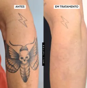 por-que-a-hell-tattoo-tem-um-preco-mais-elevado-do-que-outras-clinicas