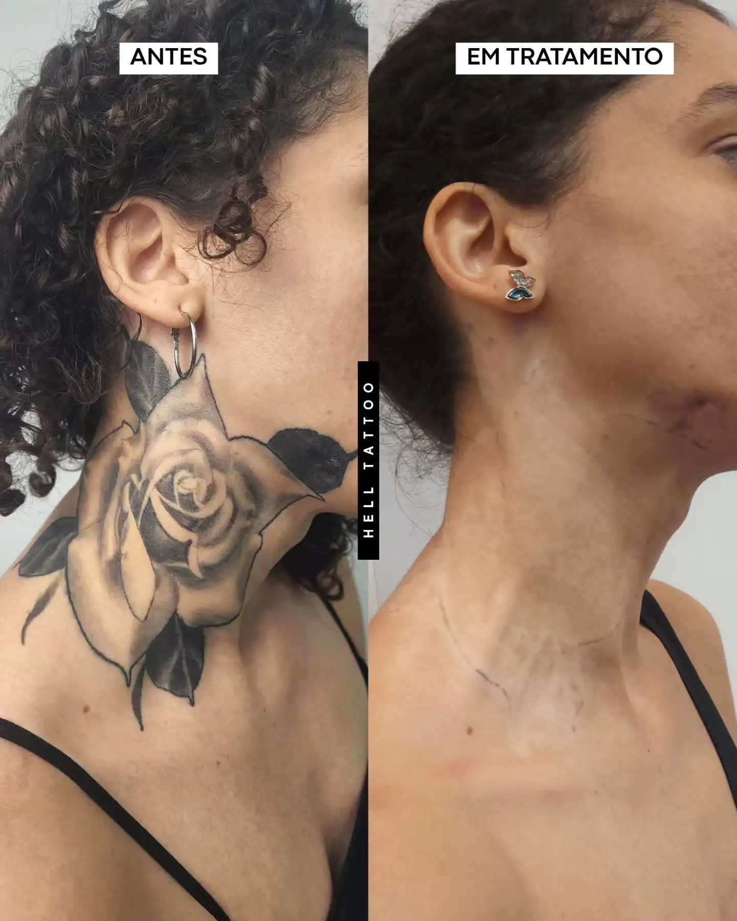 tatuagem-com-sombra-demora-mais-para-sair-01