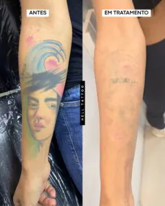 tatuagem feita por amador-02