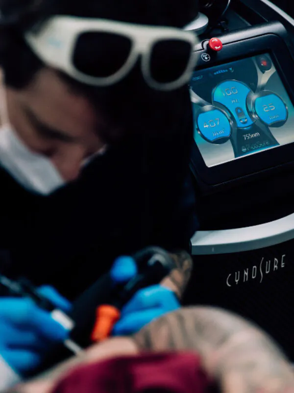 Como ganhar dinheiro com remoção de tatuagens